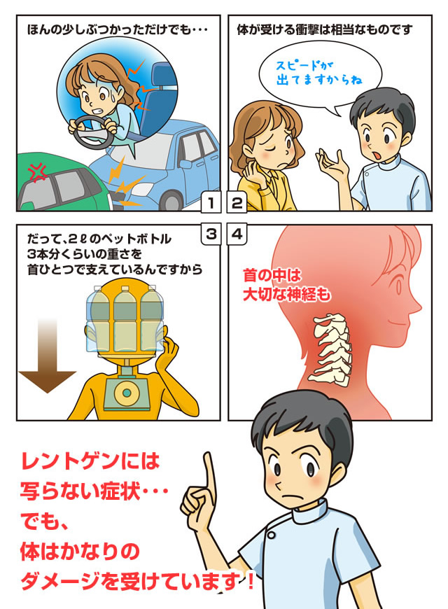 レントゲンではわかりません