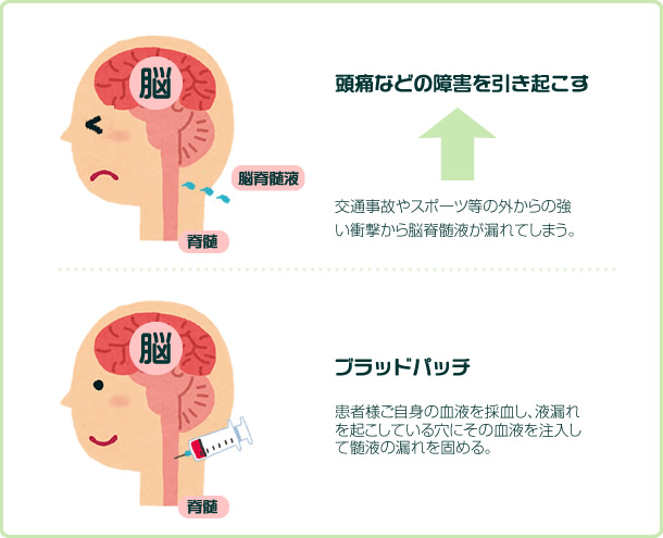 脳髄液のメカニズム